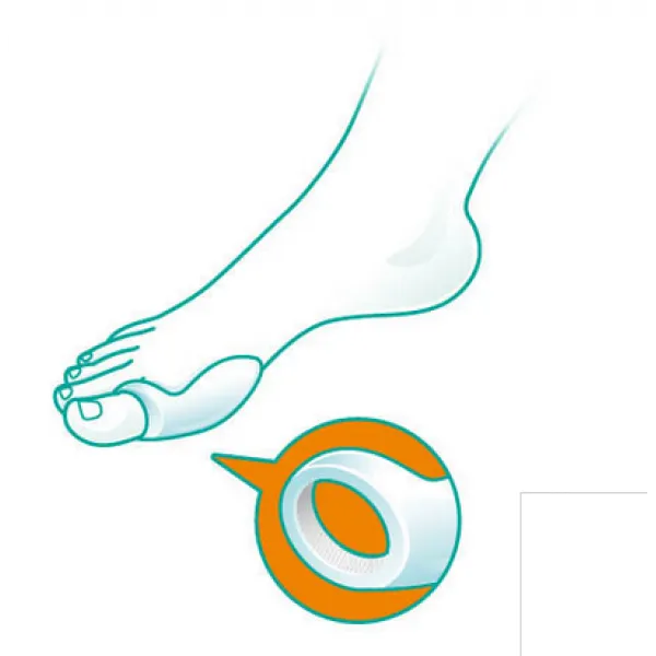 Бурсопротектор Oppo 6443